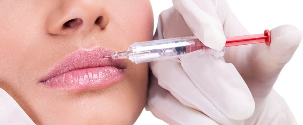 lip augmentation health procedure done in costa rica
 - Costa Rica